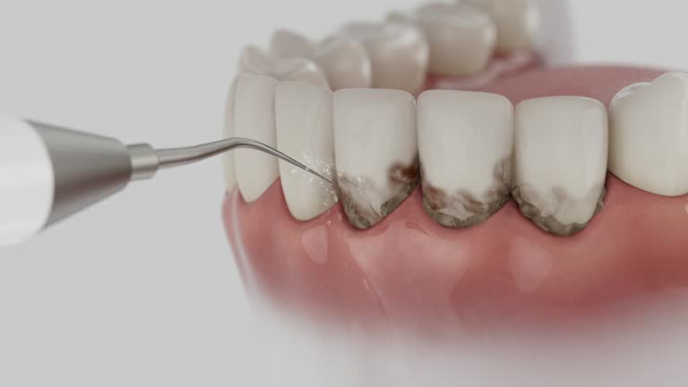 Trusted Teeth Cleaning And Checkup service in Bethel Manor, VA - Dentist Open Now